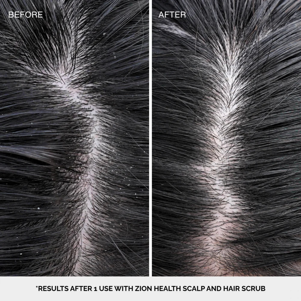 Deep Cleansing Scalp & Hair Scrub Sweet Amber